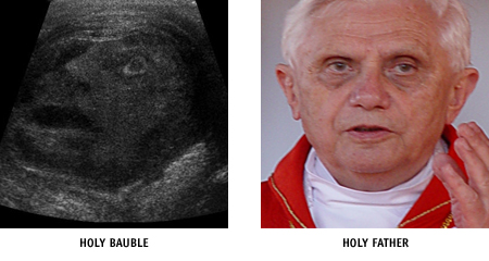pope and testicle